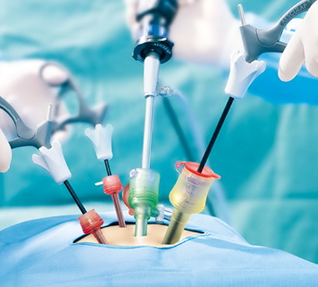 Diagnostic Laparoscopy & Hysteroscopy in Gota, Ahmedabad